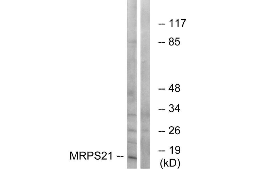 Western Blot - Anti-MRPS21 Antibody (C16653) - Antibodies.com