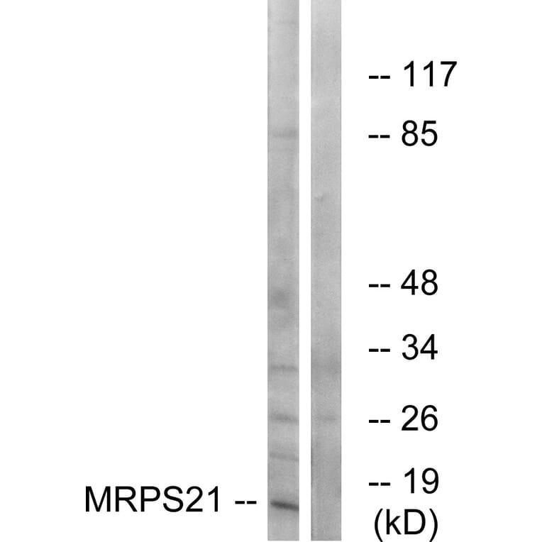 Western Blot - Anti-MRPS21 Antibody (C16653) - Antibodies.com