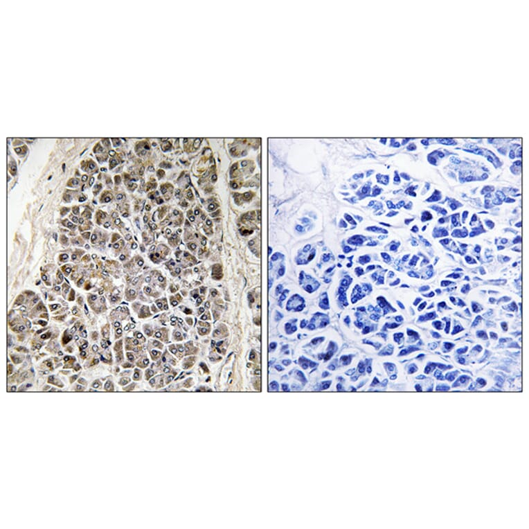 Immunohistochemistry - Anti-MRPS21 Antibody (C16653) - Antibodies.com