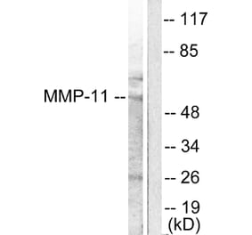 Western Blot - Anti-MMP-11 Antibody (C0264) - Antibodies.com