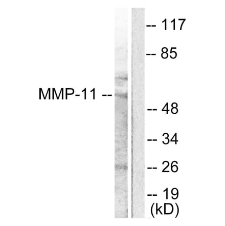 Western Blot - Anti-MMP-11 Antibody (C0264) - Antibodies.com