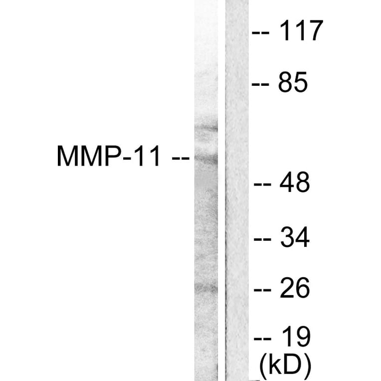 Western Blot - Anti-MMP-11 Antibody (C0264) - Antibodies.com