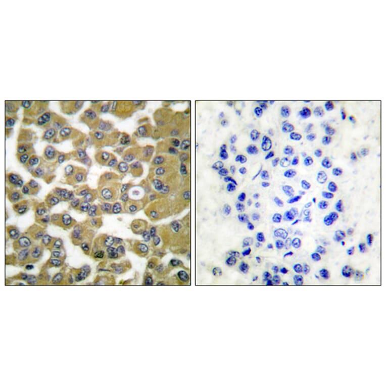 Immunohistochemistry - Anti-MMP-11 Antibody (C0264) - Antibodies.com