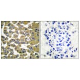 Immunohistochemistry - Anti-MMP-11 Antibody (C0264) - Antibodies.com