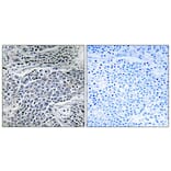 Immunohistochemistry - Anti-MMP-11 Antibody (C0264) - Antibodies.com
