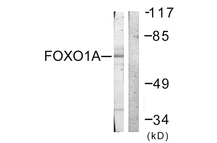 Western Blot - Anti-FOXO1A Antibody (B0484) - Antibodies.com