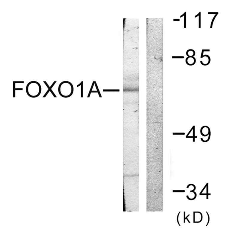 Western Blot - Anti-FOXO1A Antibody (B0484) - Antibodies.com