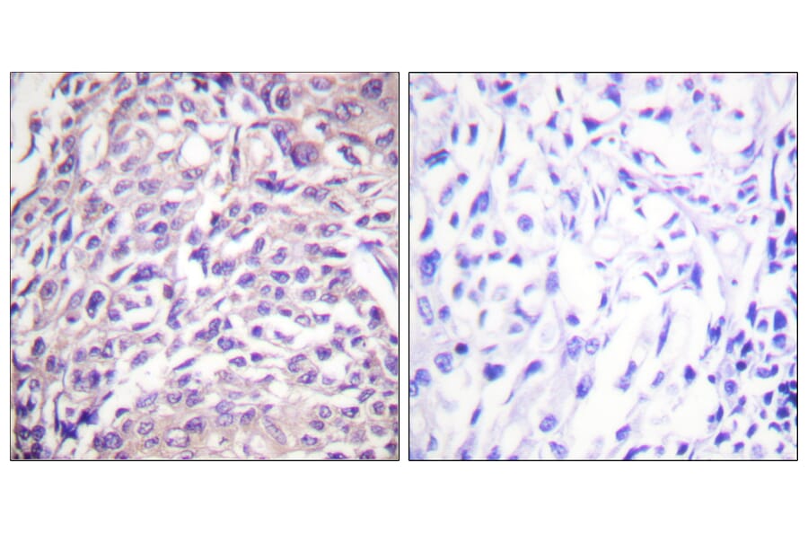 Immunohistochemistry - Anti-FOXO1A Antibody (B0484) - Antibodies.com