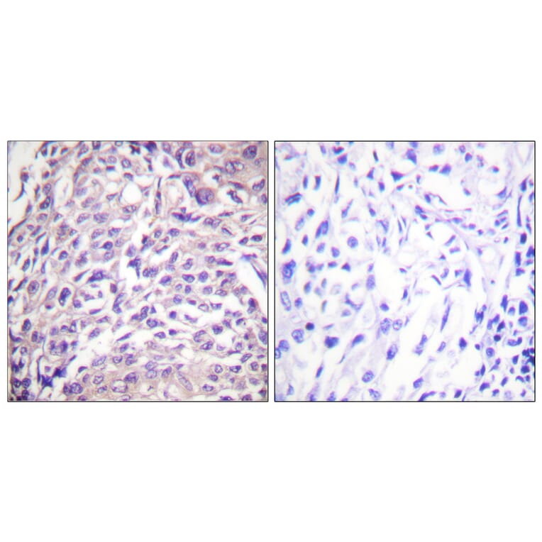 Immunohistochemistry - Anti-FOXO1A Antibody (B0484) - Antibodies.com