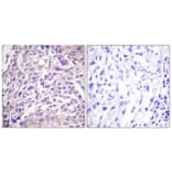 Immunohistochemistry - Anti-FOXO1A Antibody (B0484) - Antibodies.com