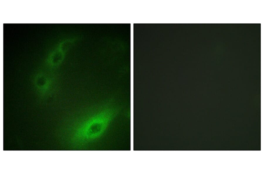 Immunofluorescence - Anti-FOXO1A Antibody (B0484) - Antibodies.com