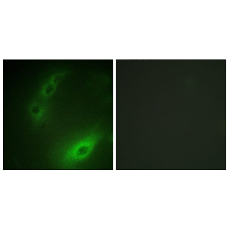 Immunofluorescence - Anti-FOXO1A Antibody (B0484) - Antibodies.com
