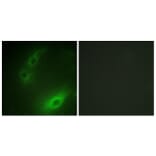 Immunofluorescence - Anti-FOXO1A Antibody (B0484) - Antibodies.com