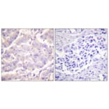 Immunohistochemistry - Anti-c-PLA2 Antibody (B0065) - Antibodies.com