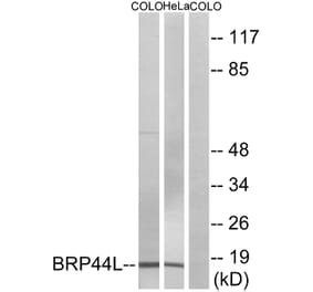 Western Blot - Anti-BRP44L Antibody (C14781) - Antibodies.com