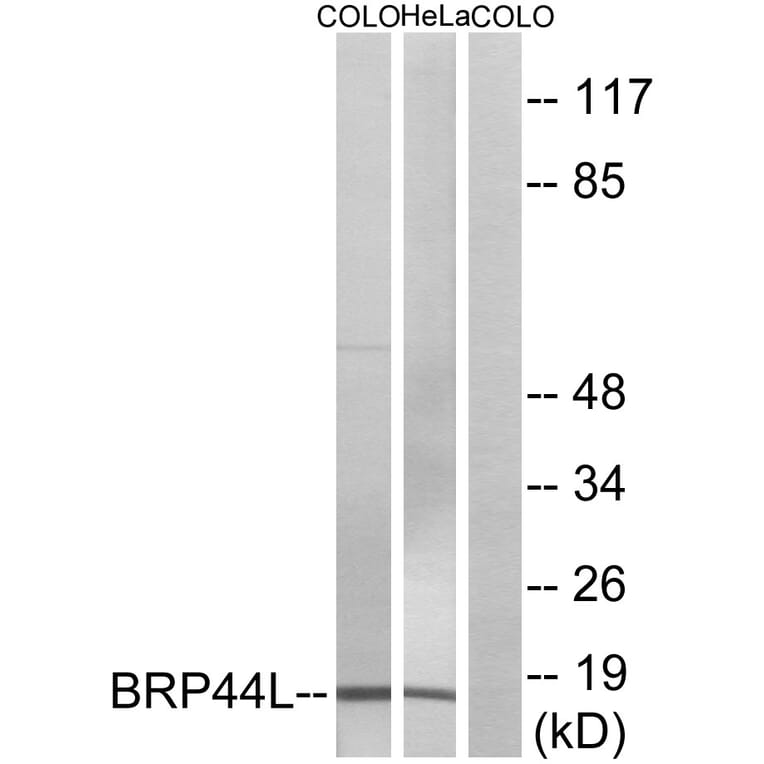 Western Blot - Anti-BRP44L Antibody (C14781) - Antibodies.com