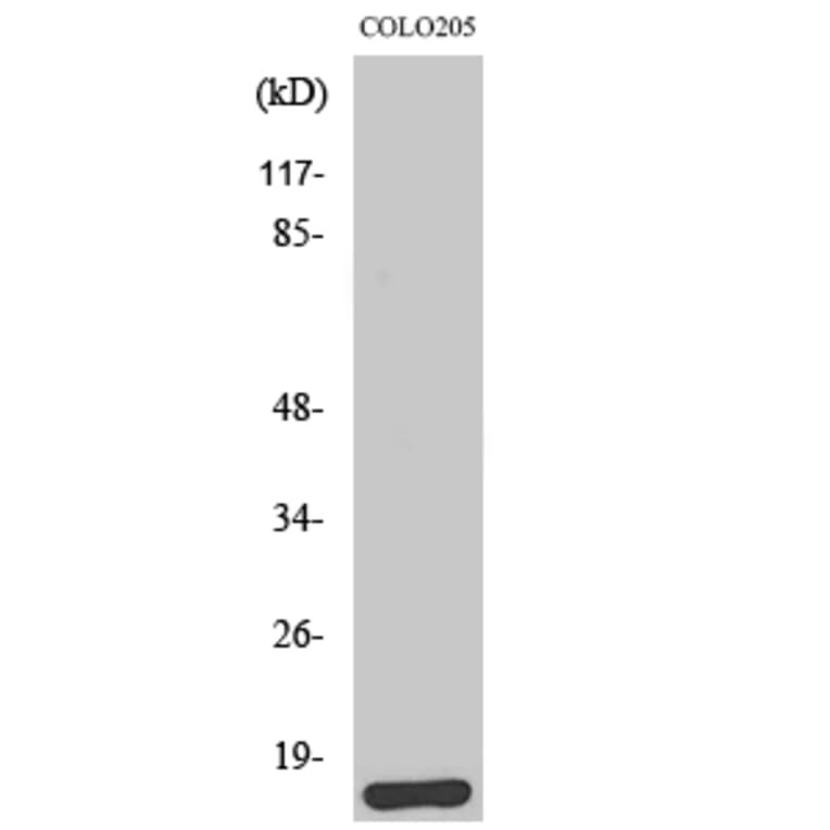 Western Blot - Anti-BRP44L Antibody (C14781) - Antibodies.com