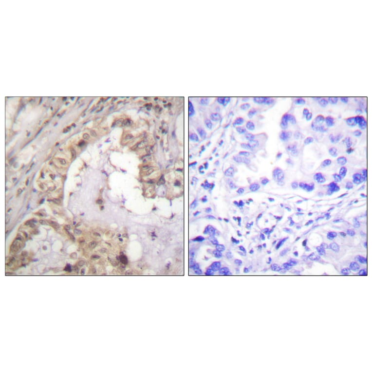 Immunohistochemistry - Anti-BCL-XL Antibody (B0775) - Antibodies.com