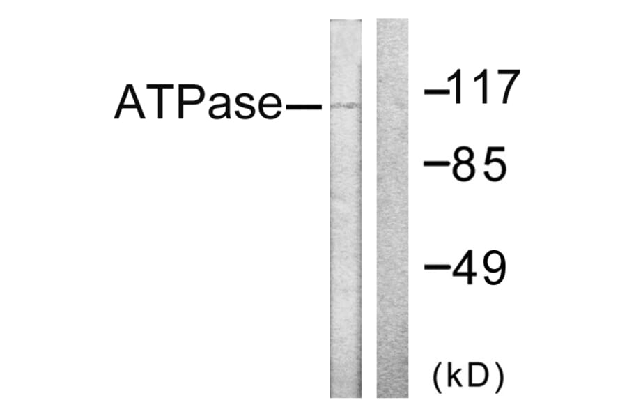 Western Blot - Anti-ATPase Antibody (B0458) - Antibodies.com