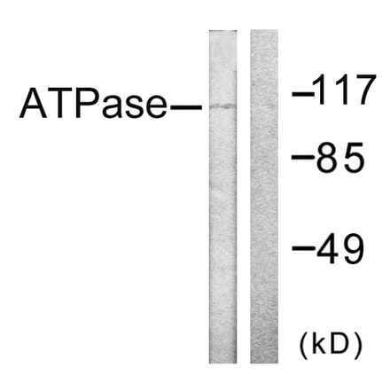 Western Blot - Anti-ATPase Antibody (B0458) - Antibodies.com