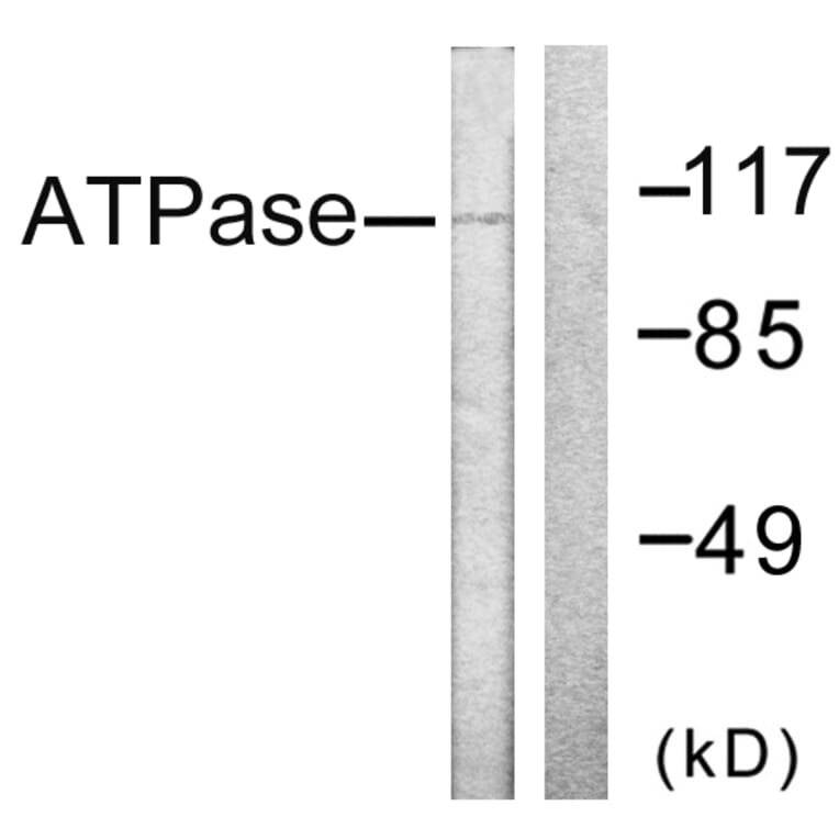 Western Blot - Anti-ATPase Antibody (B0458) - Antibodies.com