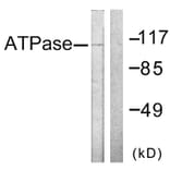 Western Blot - Anti-ATPase Antibody (B0458) - Antibodies.com