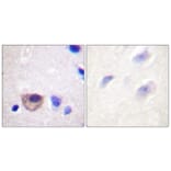 Immunohistochemistry - Anti-ATPase Antibody (B0458) - Antibodies.com