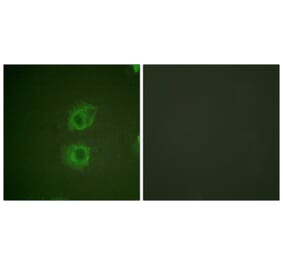 Immunofluorescence - Anti-HER3 Antibody (B0944) - Antibodies.com