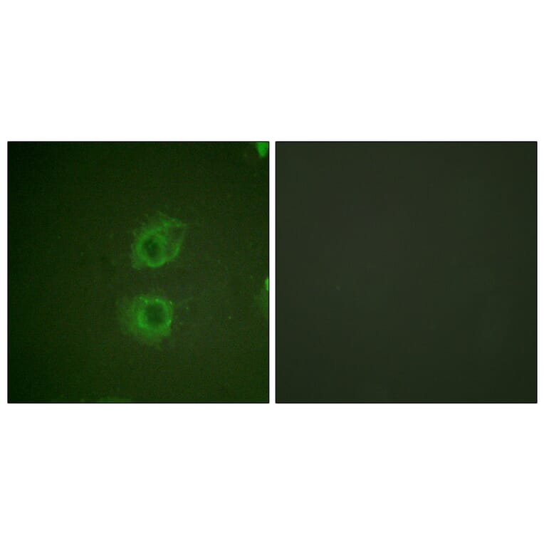 Immunofluorescence - Anti-HER3 Antibody (B0944) - Antibodies.com