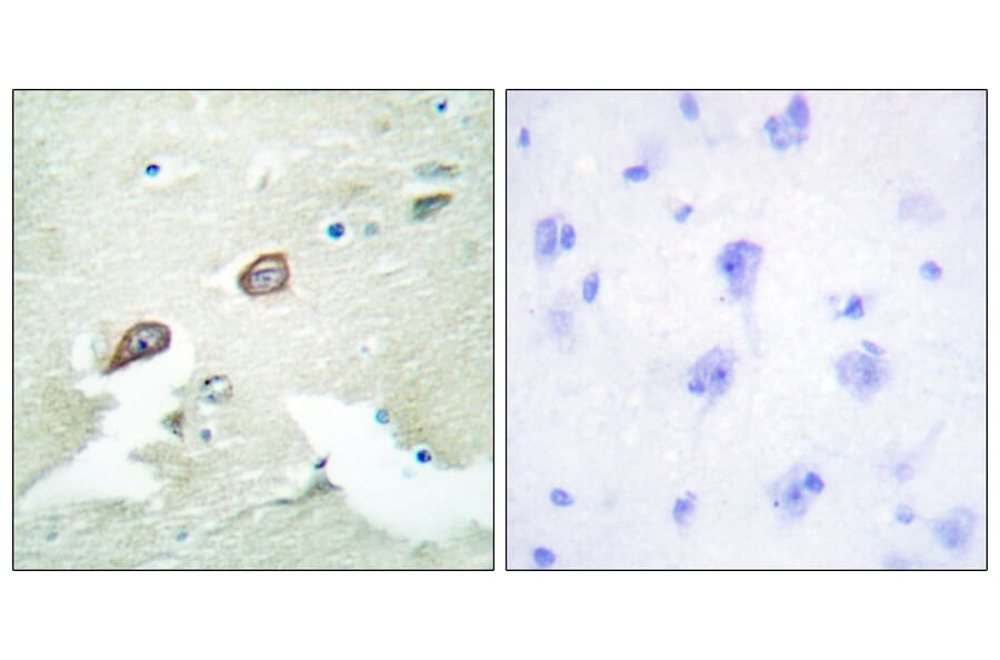 Immunohistochemistry - Anti-HER3 Antibody (B0944) - Antibodies.com