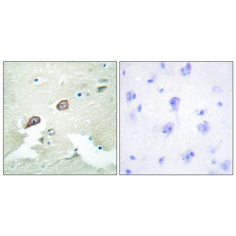 Immunohistochemistry - Anti-HER3 Antibody (B0944) - Antibodies.com