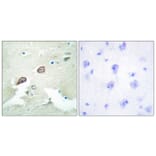 Immunohistochemistry - Anti-HER3 Antibody (B0944) - Antibodies.com