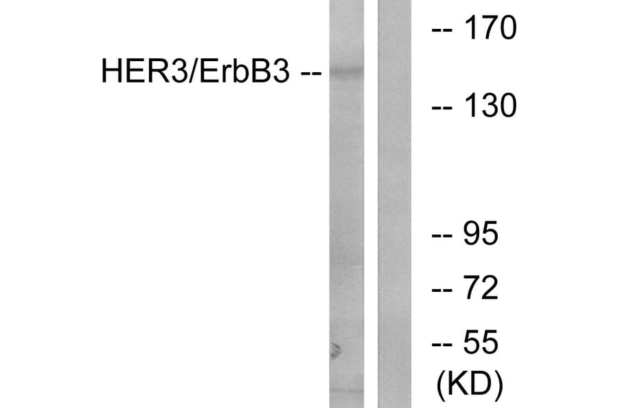 Western Blot - Anti-HER3 Antibody (B0944) - Antibodies.com