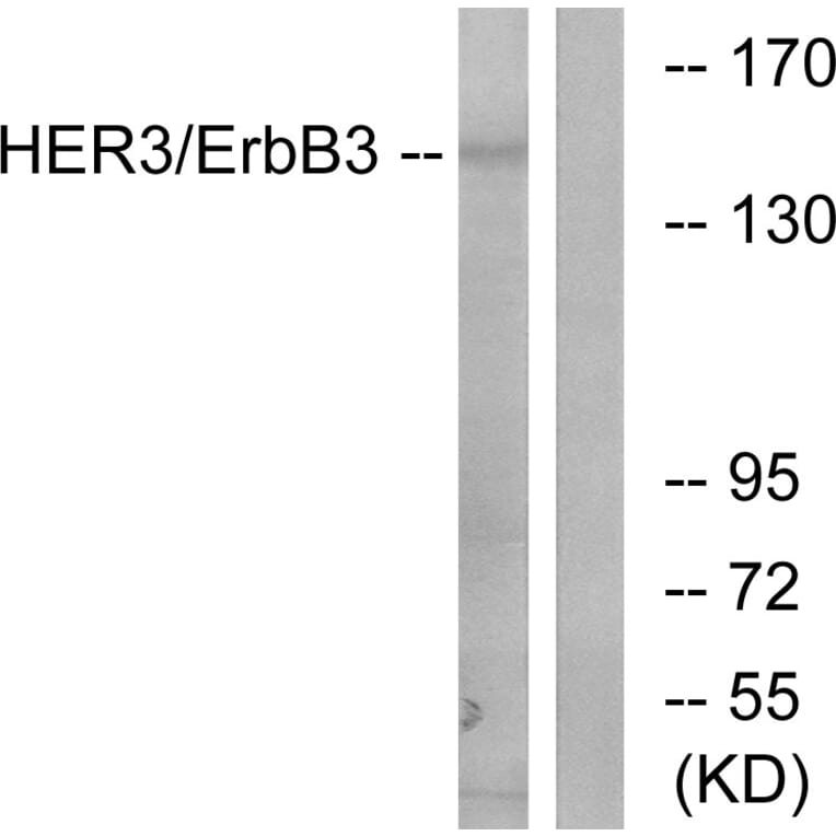 Western Blot - Anti-HER3 Antibody (B0944) - Antibodies.com