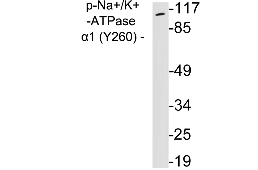 Western Blot - Anti-alpha 1 Sodium Potassium ATPase (phospho Tyr260) Antibody (P12-1036) - Antibodies.com