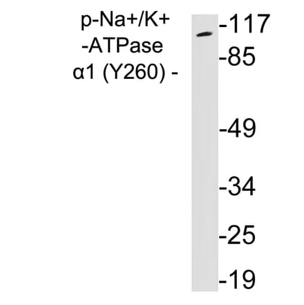 Western Blot - Anti-alpha 1 Sodium Potassium ATPase (phospho Tyr260) Antibody (P12-1036) - Antibodies.com