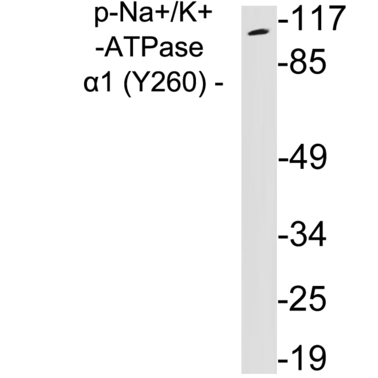 Western Blot - Anti-alpha 1 Sodium Potassium ATPase (phospho Tyr260) Antibody (P12-1036) - Antibodies.com