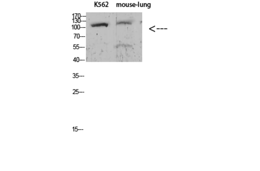 Western Blot - Anti-alpha 1 Sodium Potassium ATPase (phospho Tyr260) Antibody (P12-1036) - Antibodies.com