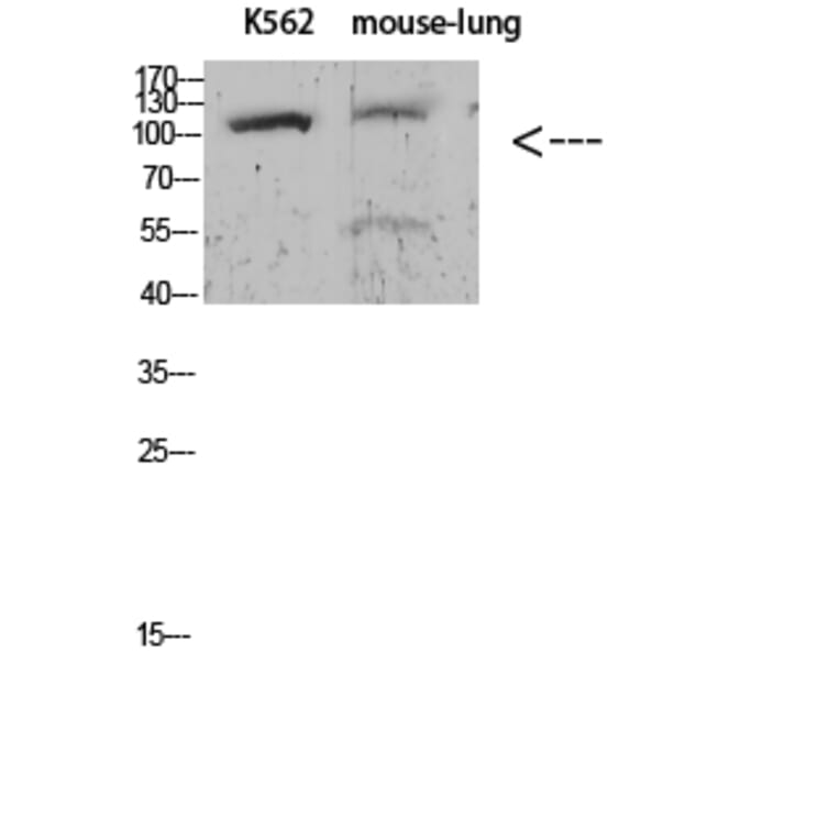 Western Blot - Anti-alpha 1 Sodium Potassium ATPase (phospho Tyr260) Antibody (P12-1036) - Antibodies.com
