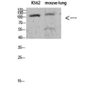 Western Blot - Anti-alpha 1 Sodium Potassium ATPase (phospho Tyr260) Antibody (P12-1036) - Antibodies.com