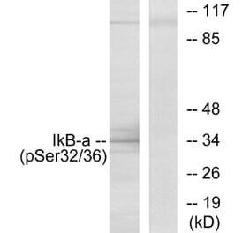 Western Blot - Anti-I kappa B alpha (phospho Ser32 + Ser36) Antibody (A7124) - Antibodies.com