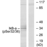 Western Blot - Anti-I kappa B alpha (phospho Ser32 + Ser36) Antibody (A7124) - Antibodies.com