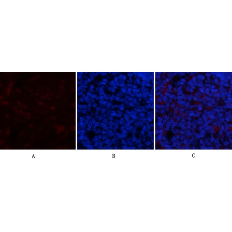 Immunofluorescence - Anti-I kappa B alpha (phospho Ser32 + Ser36) Antibody (A7124) - Antibodies.com