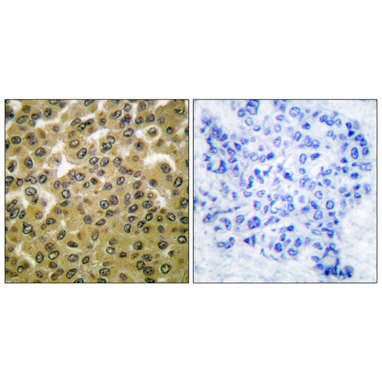 Immunohistochemistry - Anti-GSK3 alpha + beta (phospho Tyr279 + Tyr216) Antibody (A0012) - Antibodies.com