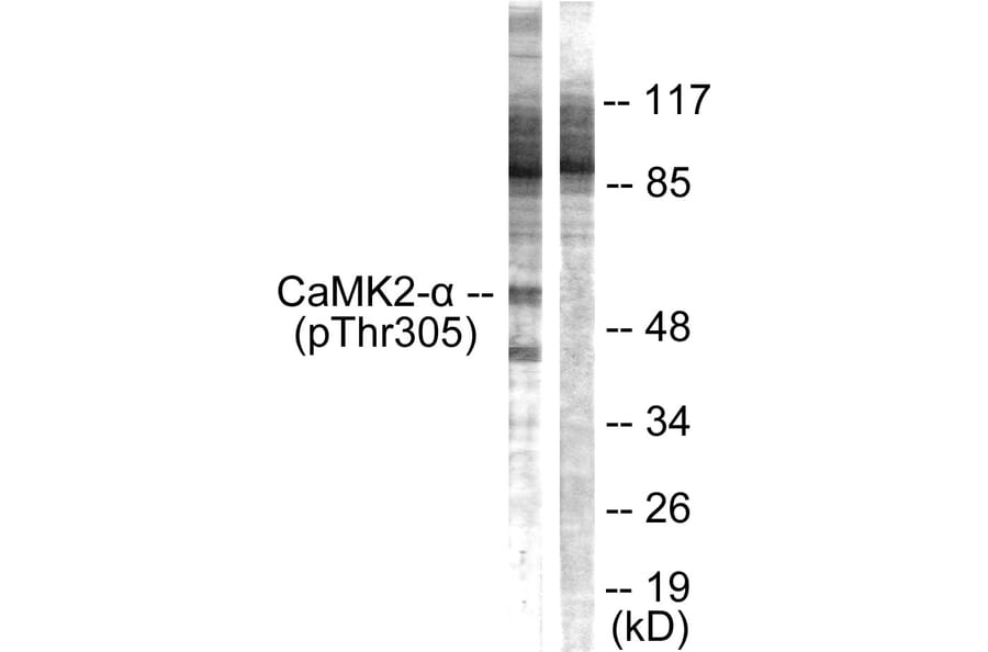 Western Blot - Anti-CaMK2 alpha + beta + delta (phospho Thr305) Antibody (A0005) - Antibodies.com