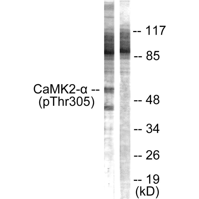 Western Blot - Anti-CaMK2 alpha + beta + delta (phospho Thr305) Antibody (A0005) - Antibodies.com