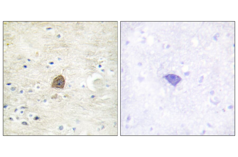 Immunohistochemistry - Anti-CaMK2 alpha + beta + delta (phospho Thr305) Antibody (A0005) - Antibodies.com
