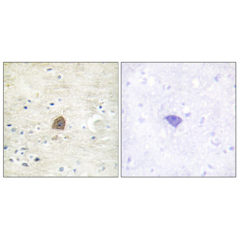 Immunohistochemistry - Anti-CaMK2 alpha + beta + delta (phospho Thr305) Antibody (A0005) - Antibodies.com
