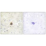 Immunohistochemistry - Anti-CaMK2 alpha + beta + delta (phospho Thr305) Antibody (A0005) - Antibodies.com