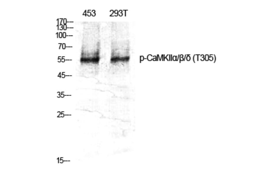 Western Blot - Anti-CaMK2 alpha + beta + delta (phospho Thr305) Antibody (A0005) - Antibodies.com